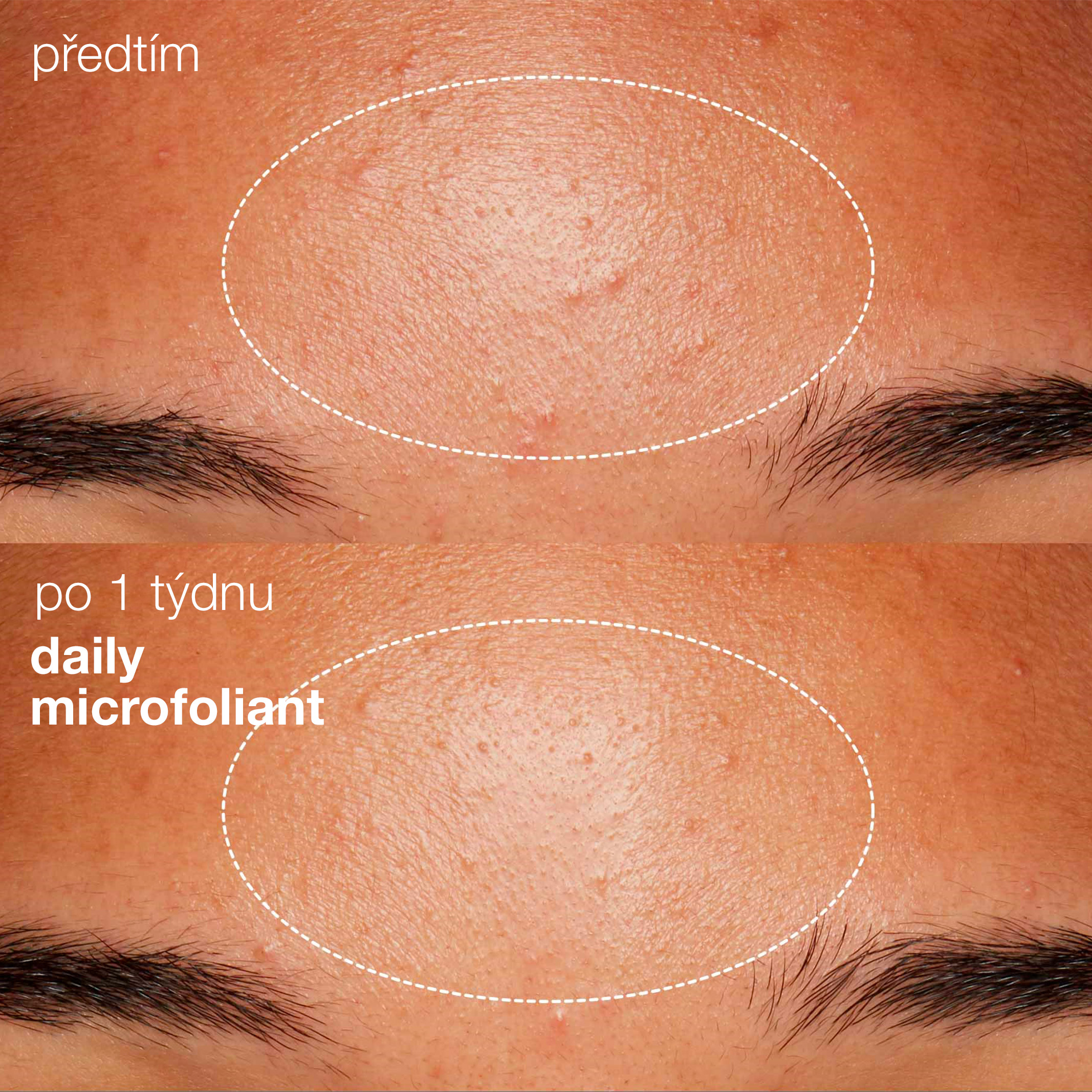 daily-microfoliant_b&a-2